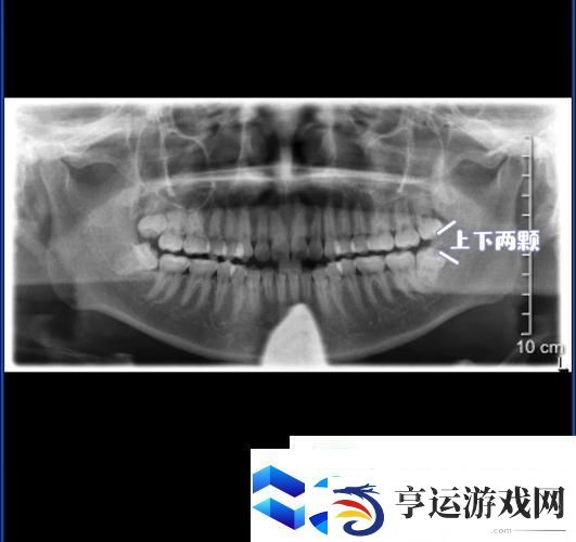 太粗大深好疼快拔出去的缓解方法：如何舒缓不适-提升体验麻生游戏攻略